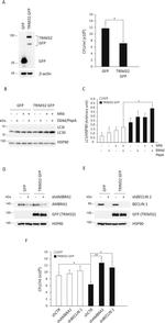 TRIM32 Antibody in Western Blot (WB)