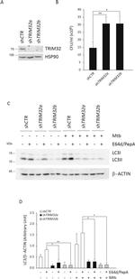 TRIM32 Antibody in Western Blot (WB)