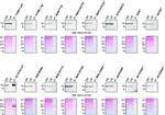 Profilin 1 Antibody in Western Blot, Immunoprecipitation (WB, IP)