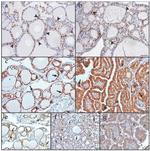 ACE2 Antibody in Immunohistochemistry (IHC)