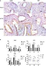 Angiotensinogen Antibody in Immunohistochemistry (Paraffin) (IHC (P))