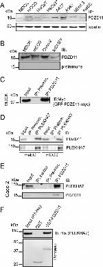 6x-His Tag Antibody in Western Blot (WB)