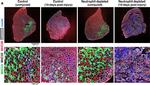 Mouse IgG1 Cross-Adsorbed Secondary Antibody in Immunohistochemistry (IHC)