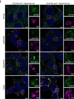 Rabbit IgG (H+L) Highly Cross-Adsorbed Secondary Antibody in Immunocytochemistry (ICC/IF)