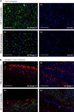 Mouse IgG1 Cross-Adsorbed Secondary Antibody in Immunohistochemistry (IHC)