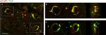 Mouse IgG2a Cross-Adsorbed Secondary Antibody in Immunohistochemistry (IHC)