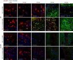 Mouse IgG2a Cross-Adsorbed Secondary Antibody in Immunohistochemistry (IHC)