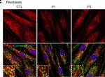 Rabbit IgG (H+L) Highly Cross-Adsorbed Secondary Antibody in Immunocytochemistry (ICC/IF)