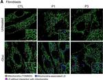 Rabbit IgG (H+L) Highly Cross-Adsorbed Secondary Antibody in Immunocytochemistry (ICC/IF)