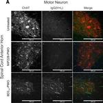 Human IgG (H+L) Cross-Adsorbed Secondary Antibody in Immunohistochemistry (IHC)