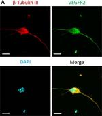 Rabbit IgG (H+L) Highly Cross-Adsorbed Secondary Antibody in Immunocytochemistry (ICC/IF)