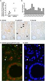 CD163 Antibody in Immunohistochemistry (IHC)