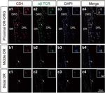 TCR alpha/beta Antibody in Immunocytochemistry, Immunohistochemistry (ICC/IF, IHC)