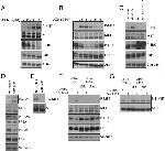 Phospho-c-Met (Ser985) Antibody in Western Blot (WB)