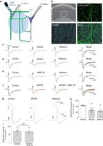 CaMKII alpha Antibody in Immunohistochemistry (IHC)