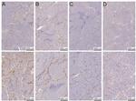 CD34 Antibody in Immunohistochemistry (IHC)