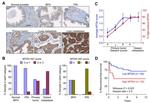 Metadherin Antibody in Immunohistochemistry (IHC)