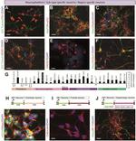 SATB2 Antibody in Immunocytochemistry (ICC/IF)