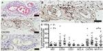 CD35 Antibody in Immunohistochemistry (IHC)
