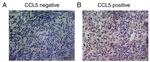 CCL5 (RANTES) Antibody in Immunohistochemistry (IHC)