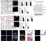 FceR1 alpha Antibody in Western Blot (WB)