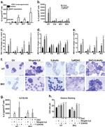 IL-6 Antibody in T-Cell Activation (TCA)