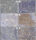 ANGPTL4 Antibody in Immunohistochemistry (IHC)