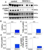 CaMKII alpha Antibody in Western Blot (WB)