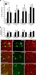 CaMKII alpha Antibody in Immunohistochemistry (IHC)