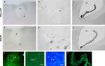 Transthyretin Antibody in Immunohistochemistry (IHC)