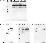 Transthyretin Antibody in Western Blot (WB)