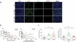 FOXP3 Antibody in Immunohistochemistry (IHC)