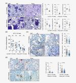 Ki-67 Antibody in Immunohistochemistry (IHC)