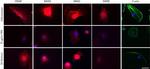 Nephrin Antibody in Immunocytochemistry, Immunohistochemistry (ICC/IF, IHC)