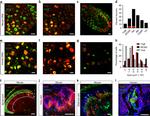 TrkA Antibody in Immunohistochemistry (IHC)