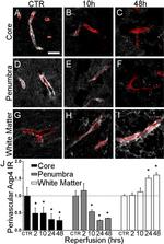 RECA-1 Antibody in Immunohistochemistry (IHC)