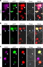 VPS8 Antibody in Immunohistochemistry (IHC)