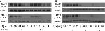 Phospho-EGFR (Tyr1068) Antibody in Western Blot (WB)