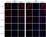 LC3B Antibody in Immunocytochemistry (ICC/IF)