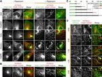 IGF2R Antibody in Immunocytochemistry (ICC/IF)