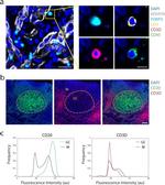 FOXP3 Antibody in Immunohistochemistry (IHC)