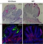 CD45 Antibody in Immunohistochemistry (IHC)