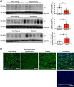 CD61 (Integrin beta 3) Antibody in Immunohistochemistry (IHC)