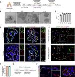 SFTPB Antibody in Immunohistochemistry, Immunohistochemistry (Paraffin) (IHC, IHC (P))