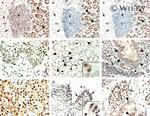 Glucocorticoid Receptor Antibody in Immunohistochemistry (IHC)