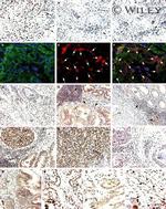 Glucocorticoid Receptor Antibody in Immunohistochemistry (IHC)