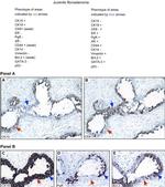 Cytokeratin 15 Antibody in Immunohistochemistry (Paraffin) (IHC (P))