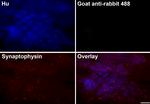 HuC/HuD Antibody in Immunohistochemistry (IHC)