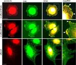 FAK Antibody in Immunocytochemistry (ICC/IF)