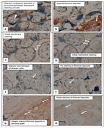 alpha-1 Antitrypsin Antibody in Immunohistochemistry (IHC)